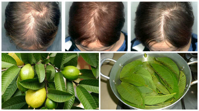 Benefits Of Guava Leaves